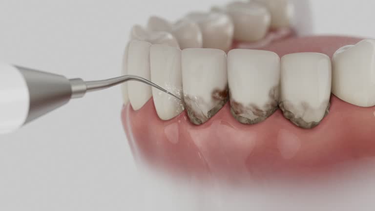 Reliable Emergency Dentist contractor in Tyndall, SD by Smile Center Dentistry